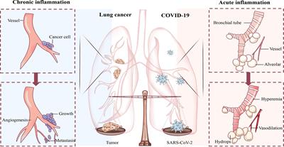 Add fuel to the fire: Inflammation and immune response in lung cancer combined with COVID-19
